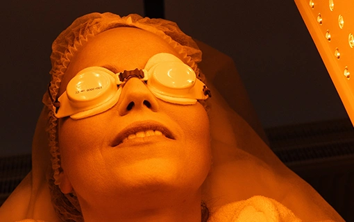 sarga-feny-kipirosodas-erzekenyseg-geo-led-fenyterapia sárga fény, érzékenység, kipirosodás, Geo led fényterápia